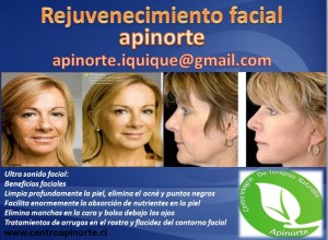 Centro Apinorte Anuncios gratis para novios en Iquique |  Limpieza Facial en Iquique, Ultrasonido Facial