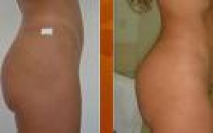 cynthia zamorano Anuncios gratis para novios en Santiago |  masajes modeladores, masajes reductivos, tratamientos a domicilio, ponte en forma para el dia de tu boda